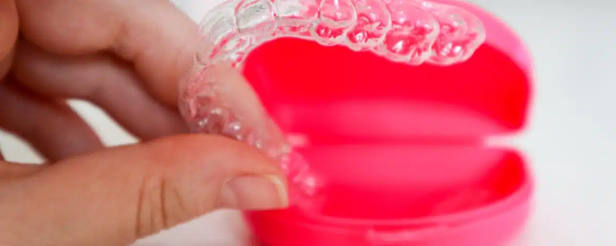 3-benefits-of-adult-orthodontic-services