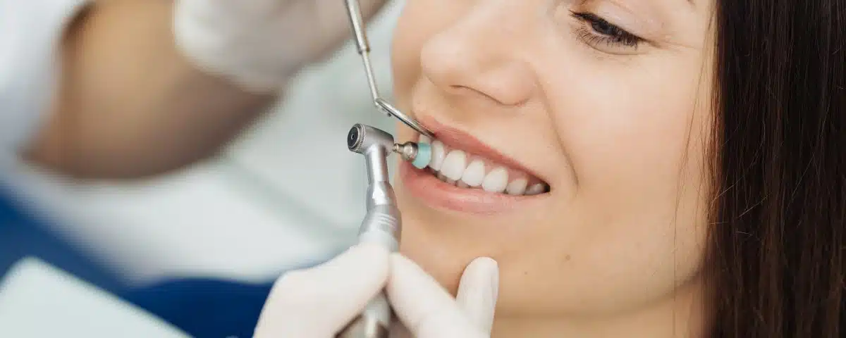 5-reasons-why-you-should-get-a-professional-dental-cleaning