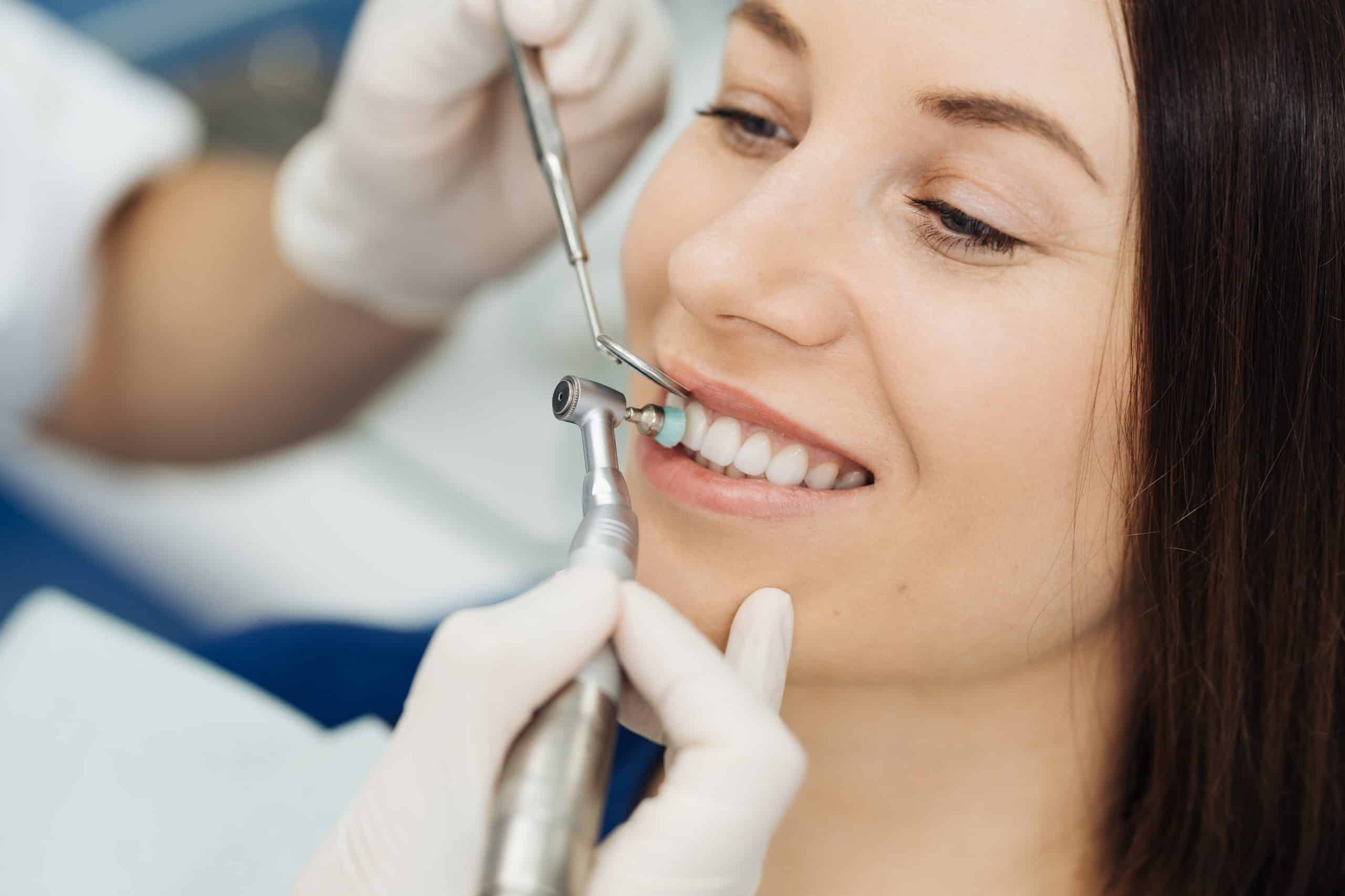 5 Reasons Why You Should Get a Professional Dental Cleaning