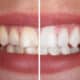 6-surprising-ways-youre-staining-your-teeth