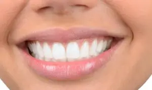 A close-up view of a woman's smile that is beautiful and straight.