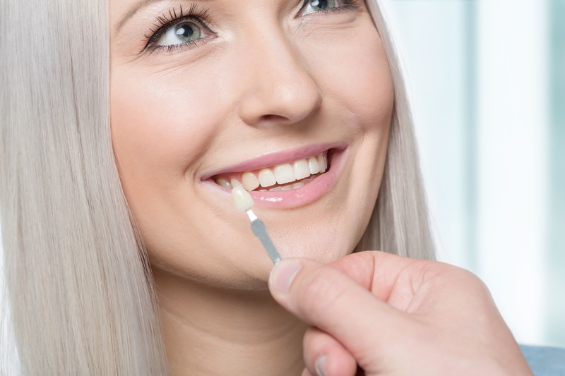 How Veneers Can Improve The Look Of Your Smile | Stonebrook Family ...