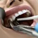 When-Will-Dentists-Pull-Teeth