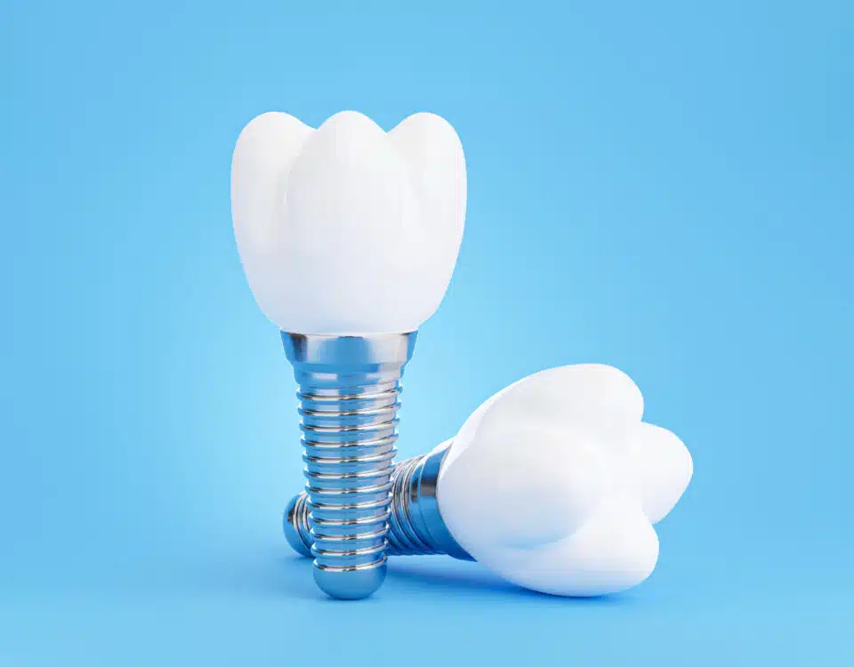 are-dental-implants-a-permanent-solution
