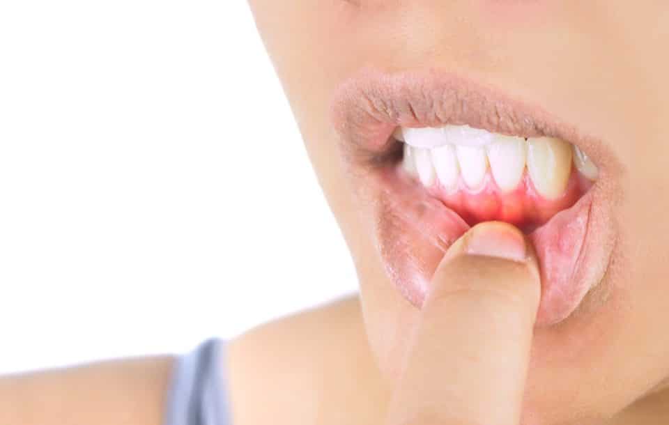 are-you-able-to-reverse-gum-disease