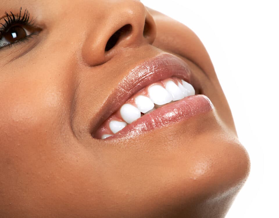 boost-your-confidence-with-teeth-whitening