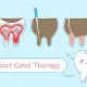 can-a-root-canal-save-your-tooth