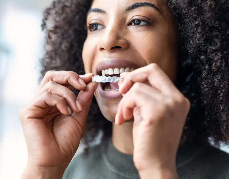 guard-your-smile-the-importance-of-nightguards-mouthguards