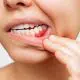gum-care-aware-what-to-know-for-gum-disease-awareness-month