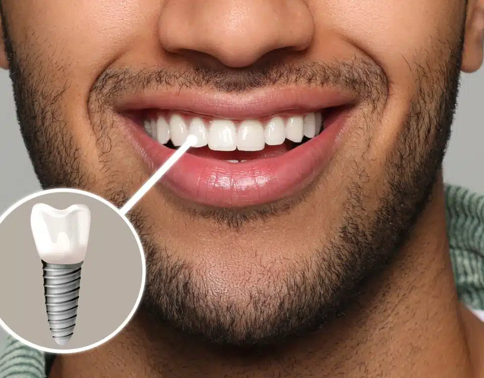 how-dental-implants-can-restore-your-smile