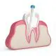 how-to-know-if-a-root-canal-is-needed