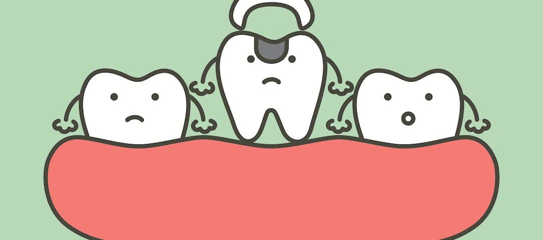 How to Prepare for a Tooth Extraction as an Adult - Dr. Kevin Varley