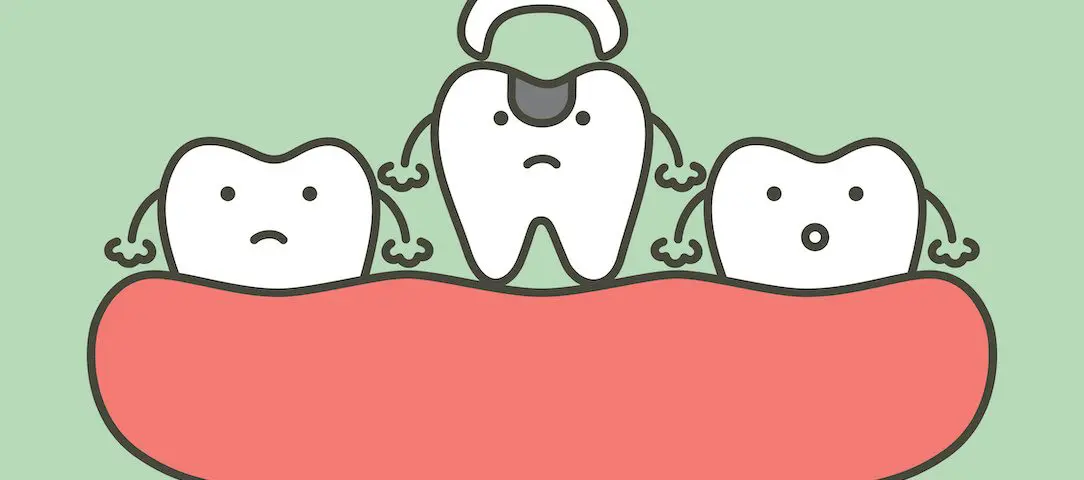 how-to-prepare-for-a-tooth-extraction-as-an-adult