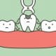 how-to-prepare-for-a-tooth-extraction-as-an-adult