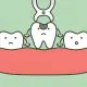 how-to-prepare-for-a-tooth-extraction-as-an-adult