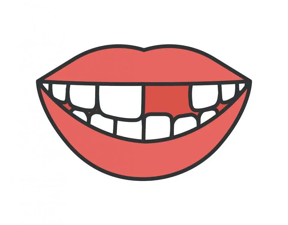 how-to-save-a-knocked-out-tooth