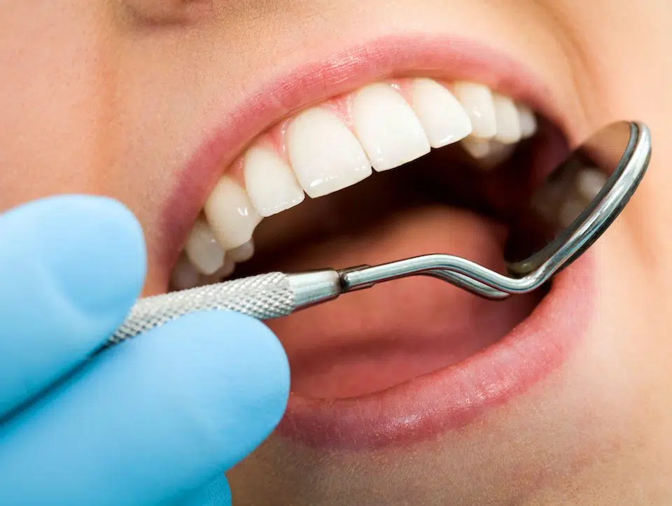new-year-fillings-restore-your-smile-with-cavity-treatment