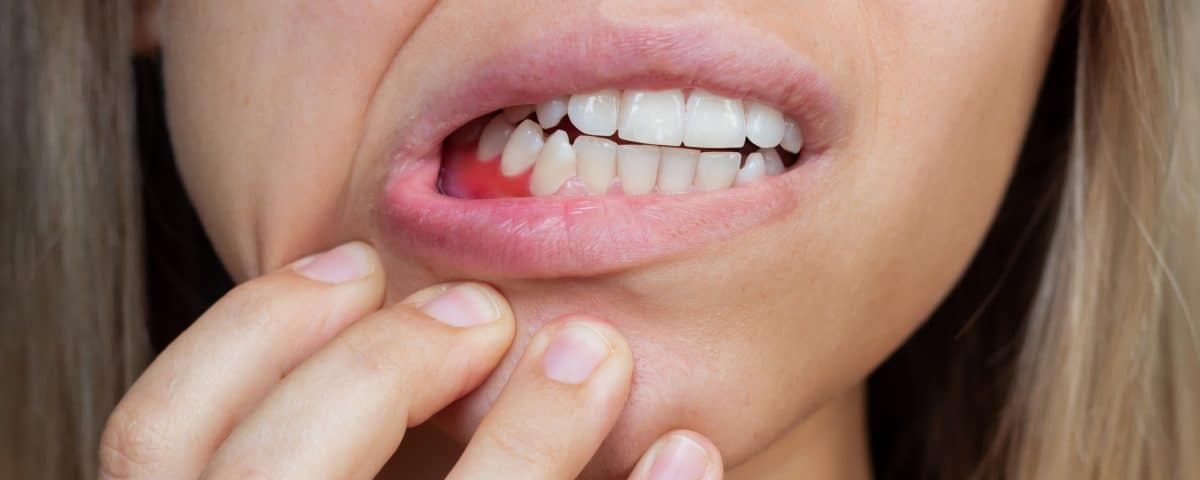 periodontitis-what-it-is-and-what-you-can-do-to-prevent-it