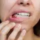 periodontitis-what-it-is-and-what-you-can-do-to-prevent-it