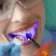 prevent-tooth-decay-with-dental-sealants