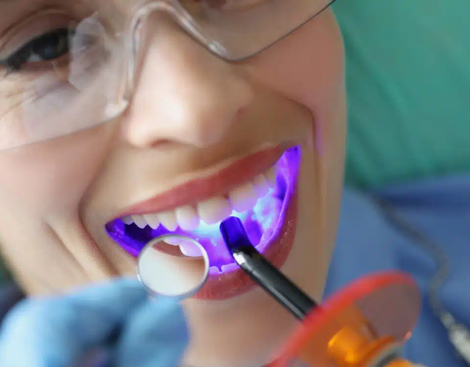 prevent-tooth-decay-with-dental-sealants