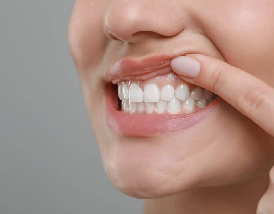 protecting-your-gums-for-a-healthier-smile-at-stonebrook-family-dental