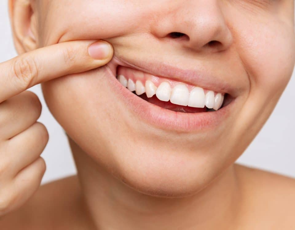 the-benefits-of-natural-looking-fillings