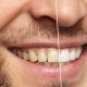 the-cosmetic-dentistry-services-that-can-boost-your-confidence