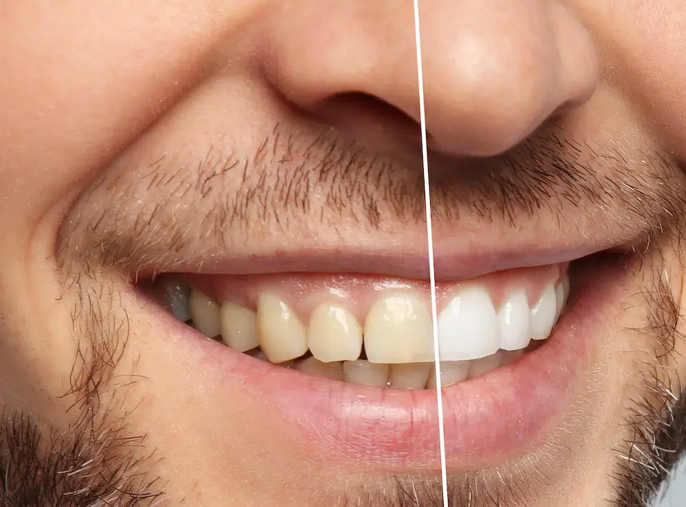the-cosmetic-dentistry-services-that-can-boost-your-confidence