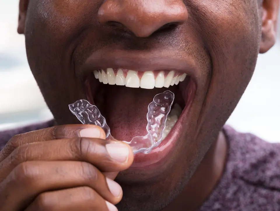 the-dangers-of-teeth-grinding