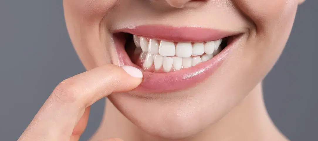 tips-for-preventing-gum-disease-during-national-dental-care-month