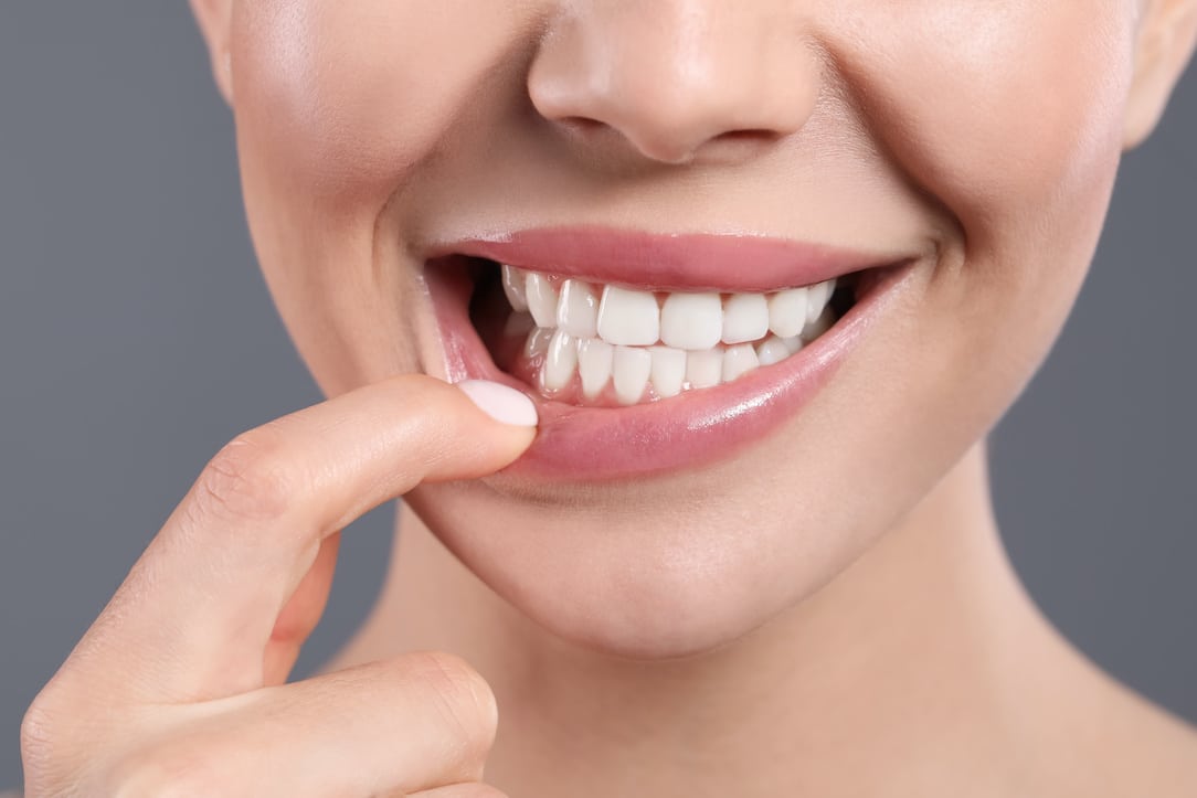 Tips For Preventing Gum Disease During National Dental Care Month