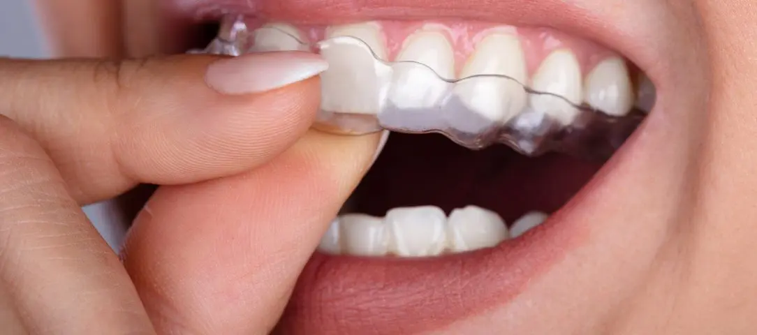tmj-awareness-month-benefits-of-night-guards
