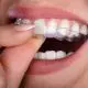 tmj-awareness-month-benefits-of-night-guards