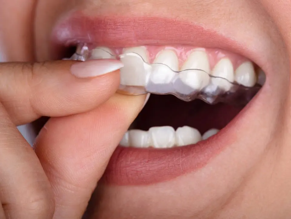 tmj-awareness-month-benefits-of-night-guards
