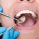 understanding-the-causes-of-cavities-and-how-to-prevent-them