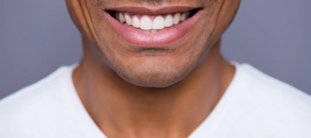 what-habits-can-make-your-teeth-whiter