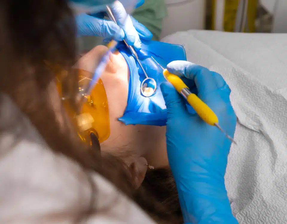why-we-treat-cavities-with-fillings