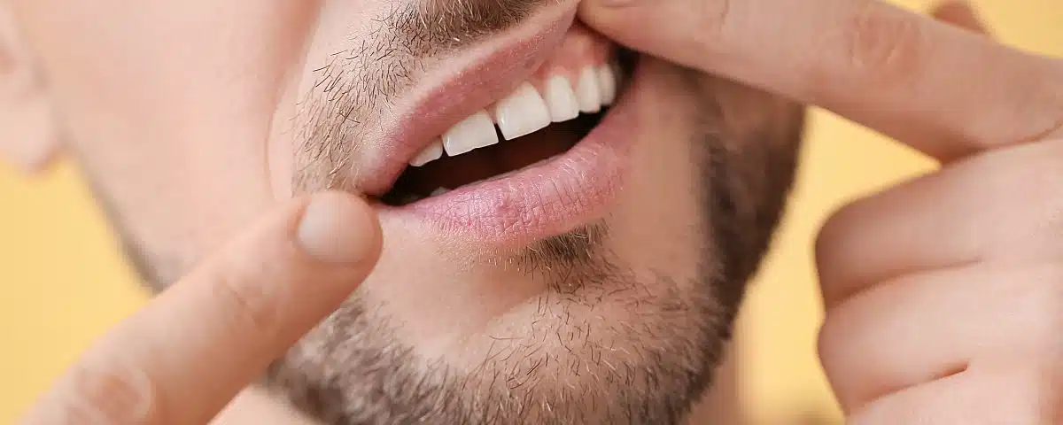 why-you-shouldnt-ignore-a-loose-tooth